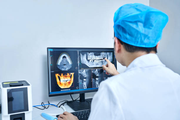 Best Emergency Dental Care for Broken or Chipped Teeth in Rome, NY